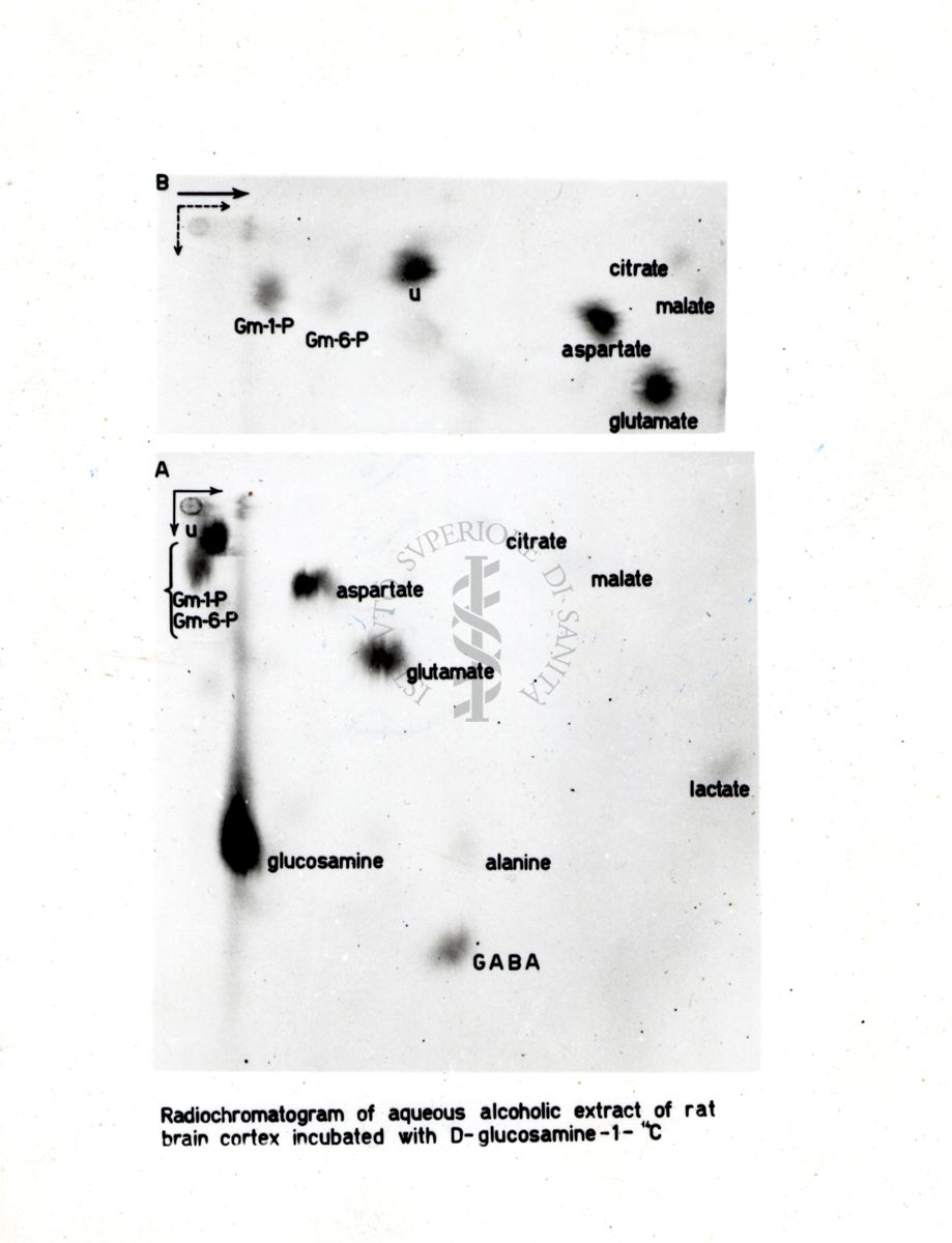 Radiocromatogramma di estratto idroalcolico di corteccia cerebrale di ratto incubata con D-glucosamina-1-14C