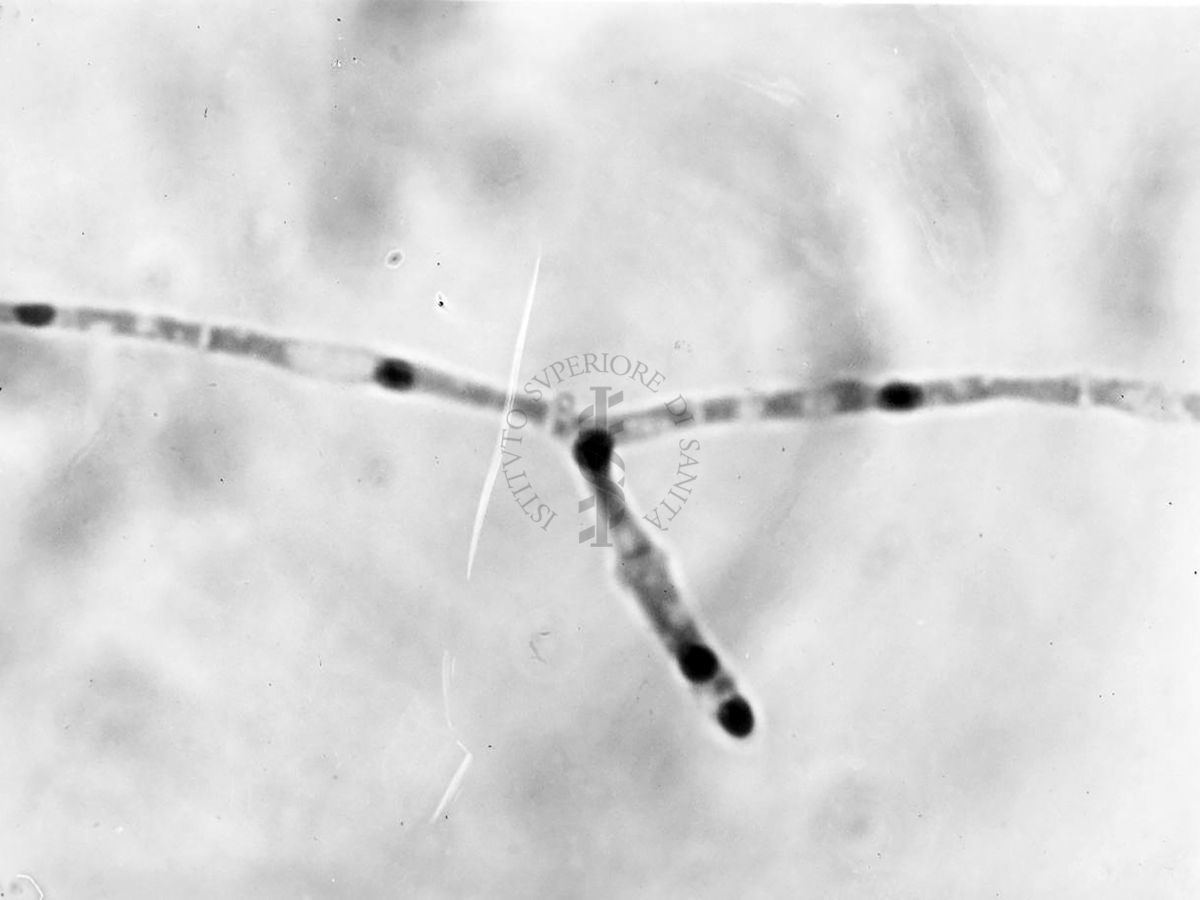 Nuclei di Penicillium Chrysogenum in cultura sommersa ingrandimento n. 2300