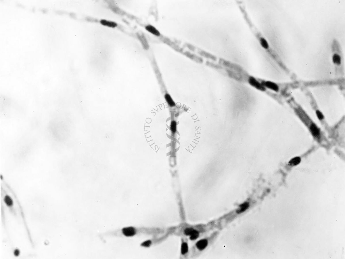 Nuclei di Penicillium Chrysogenum in cultura sommersa ingrandimento n. 2300