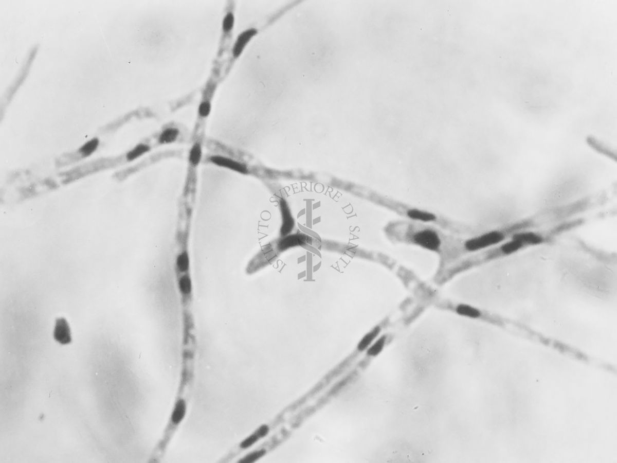 Nuclei di Penicillium Chrysogenum in cultura sommersa ingrandimento n. 2300