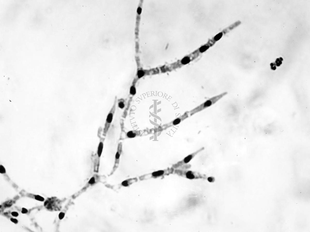 Nuclei di Penicillium Chrysogenum in cultura sommersa ingrandimento n. 1600