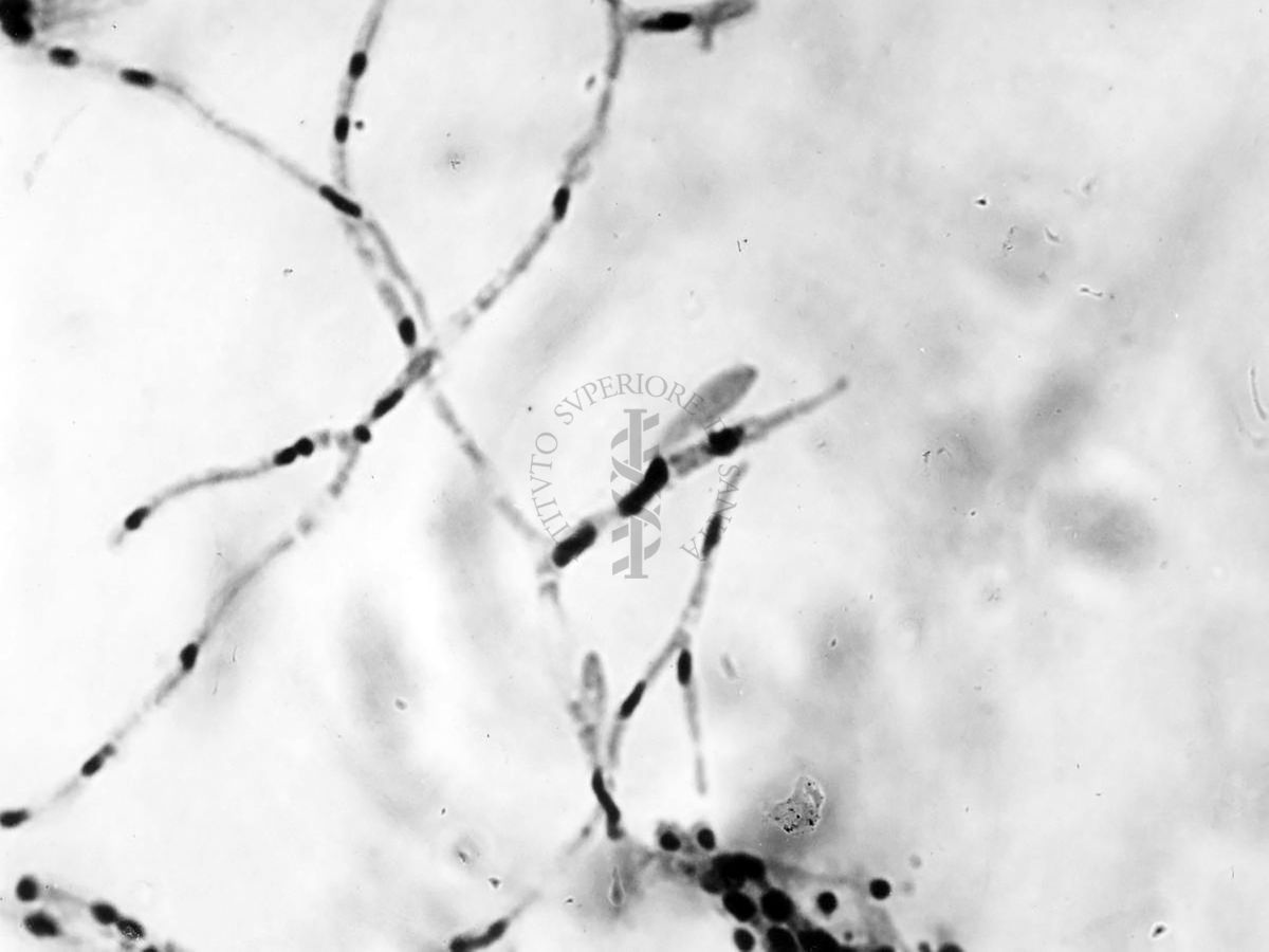 Nuclei di Penicillium Chrysogenum in cultura sommersa ingrandimento n. 1600