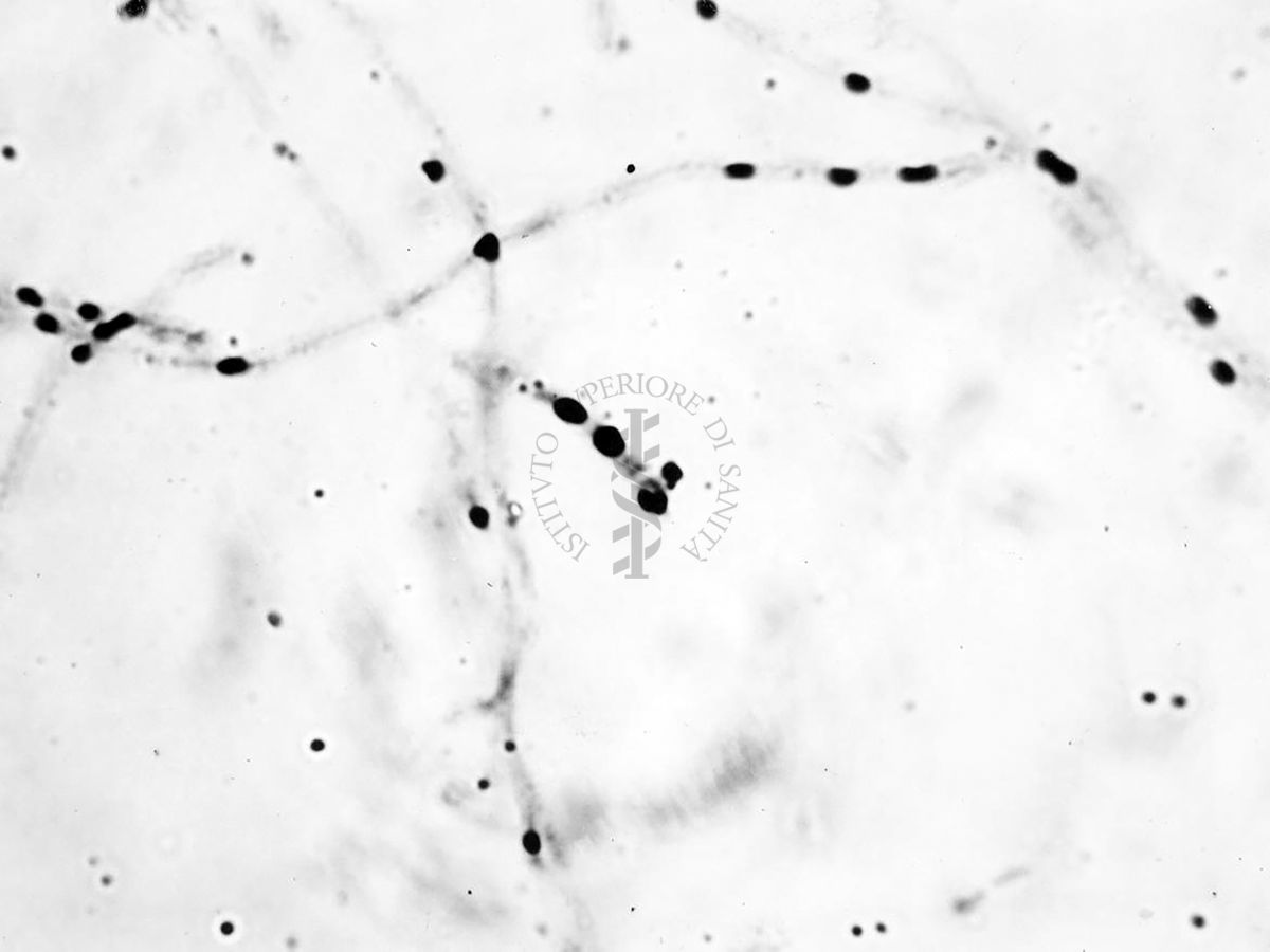 Nuclei di Penicillium Chrysogenum in cultura sommersa ingrandimento n. 1400