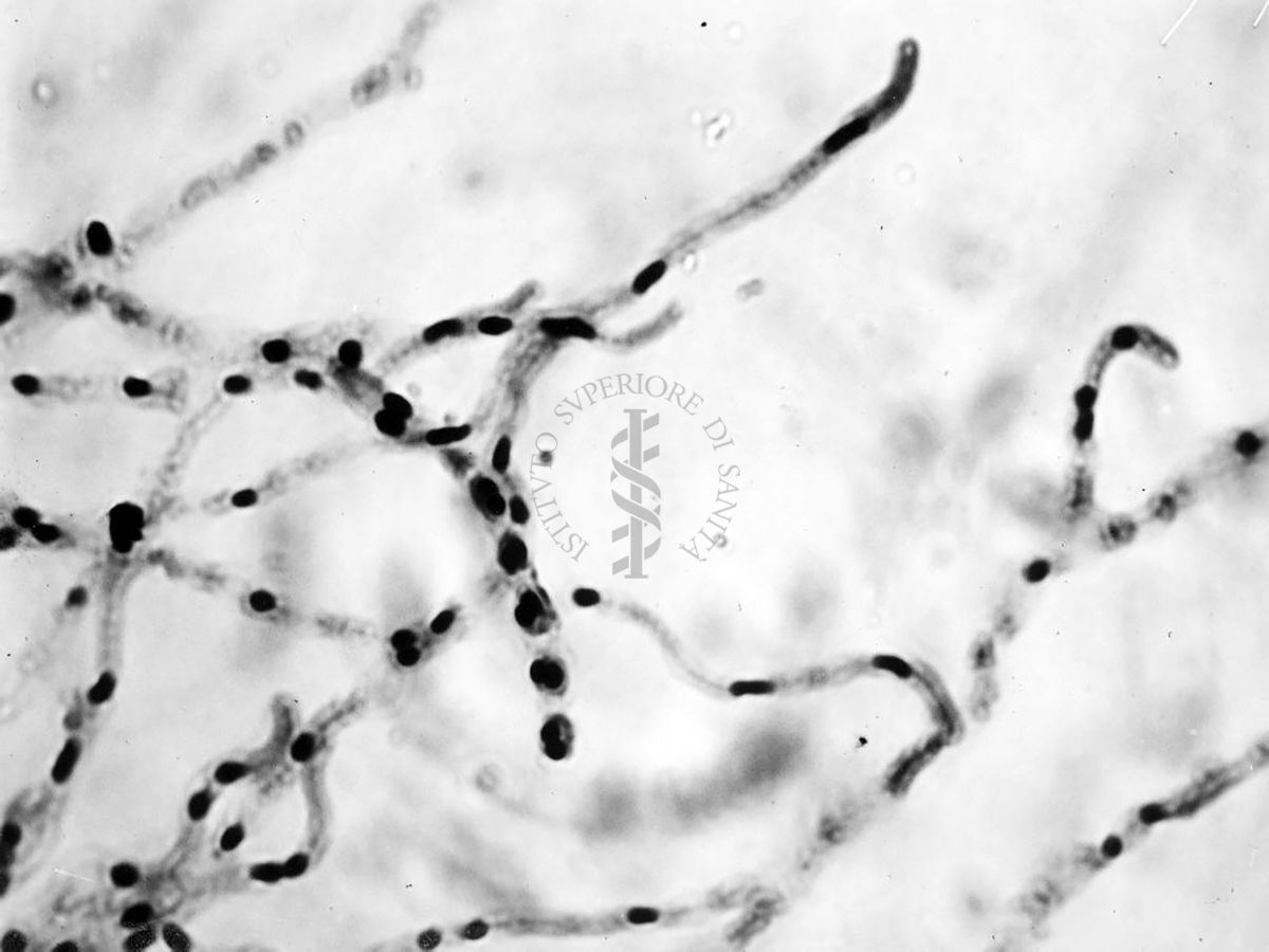 Nuclei di Penicillium Chrysogenum in cultura sommersa ingrandimento n. 1400