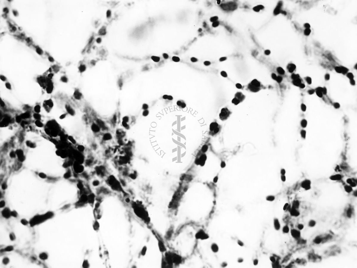 Nuclei di Penicillium Chrysogenum in cultura sommersa ingrandimento n. 1400