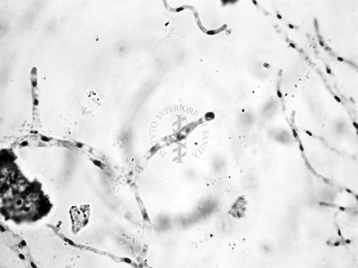 Nuclei di Penicillium Chrysogenum in cultura sommersa ingrandimento n. 1400