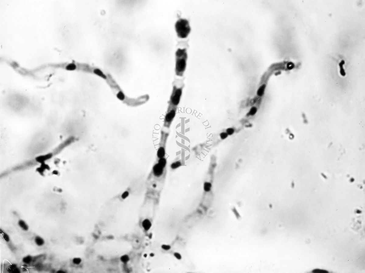 Nuclei di Penicillium Chrysogenum in cultura sommersa ingrandimento n. 2200