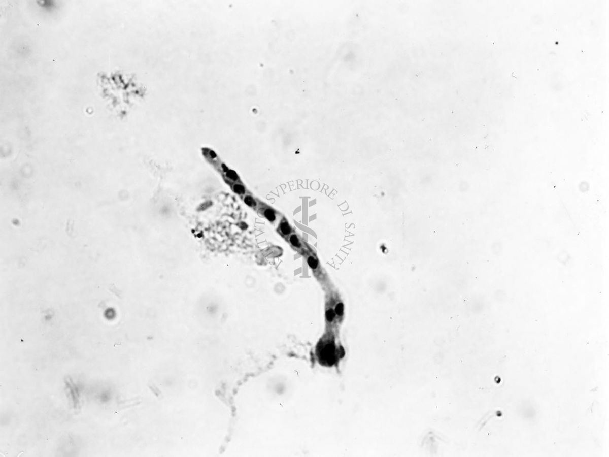 Nuclei di Penicillium Chrysogenum in cultura sommersa ingrandimento n. 1400