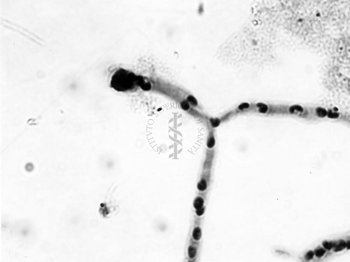 Nuclei di Penicillium Chrysogenum in cultura sommersa ingrandimento n. 1900