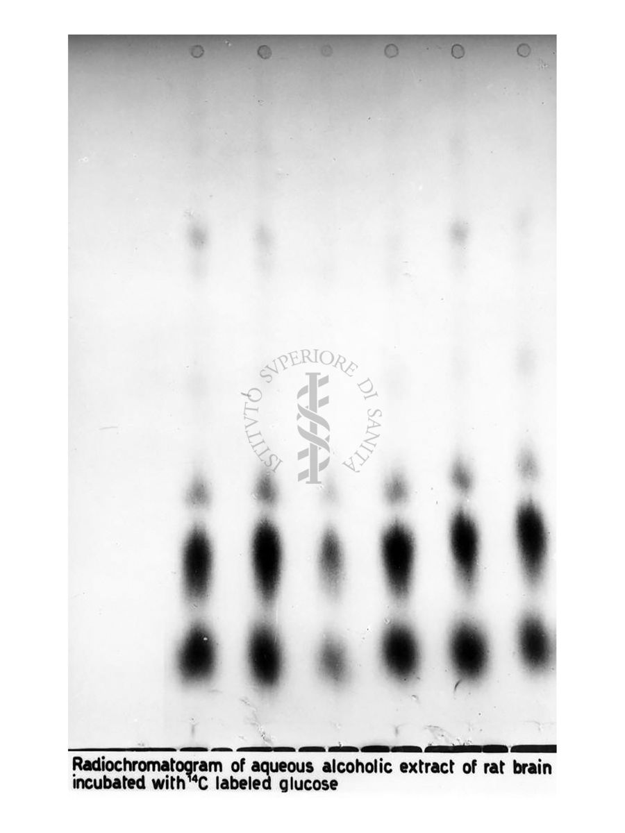 Riproduzione da radiografia estratto di cervello