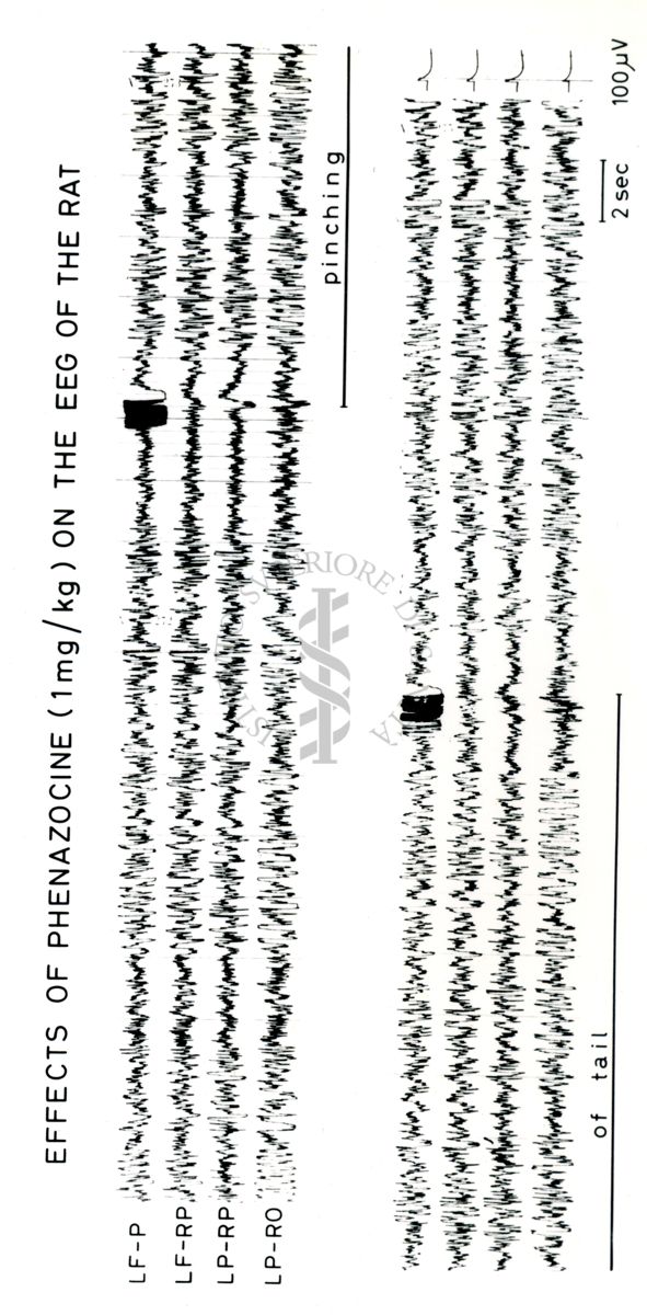 Tracciati elettroencefalografici