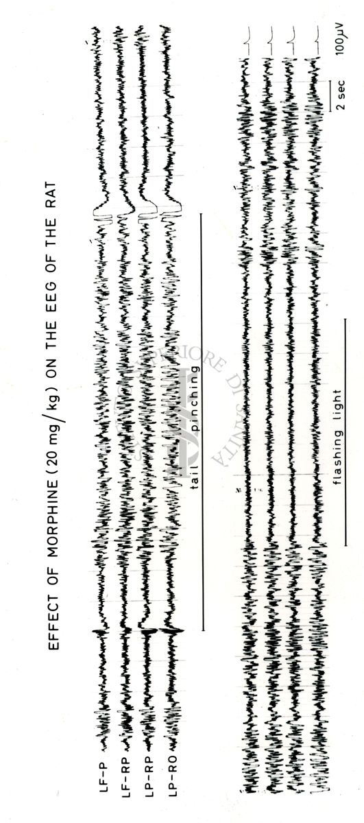 Tracciati elettroencefalografici