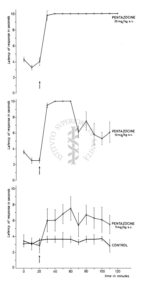 Tracciati elettroencefalografici