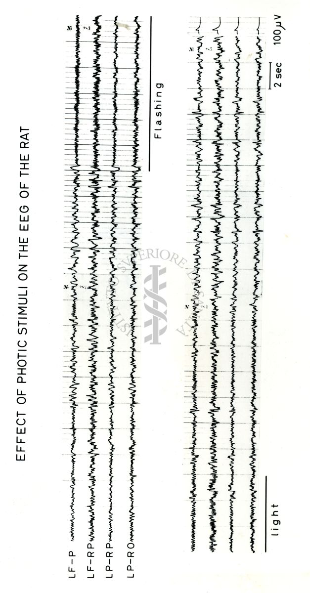 Tracciati elettroencefalografici