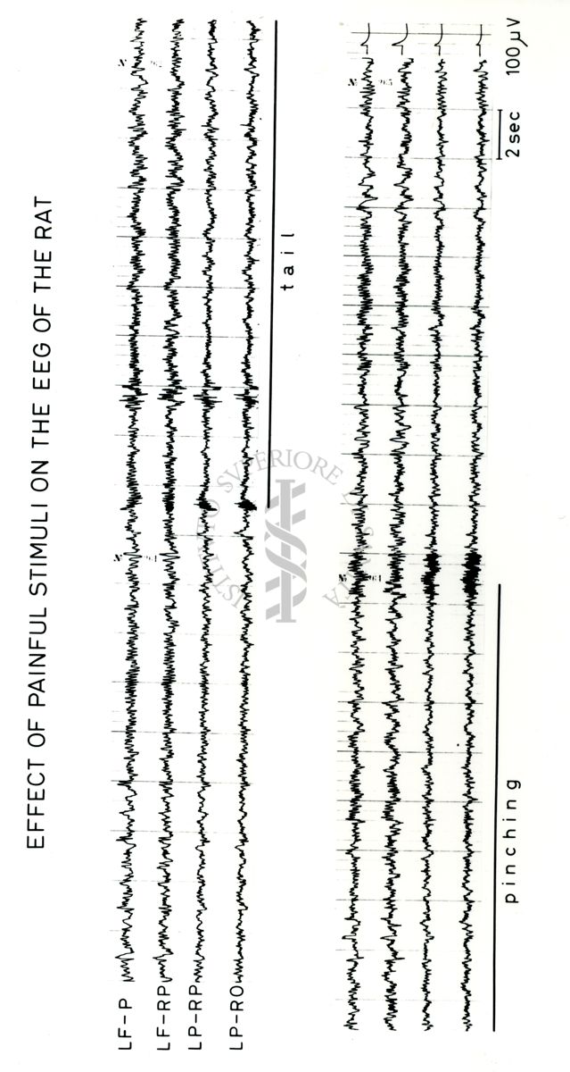 Tracciati elettroencefalografici