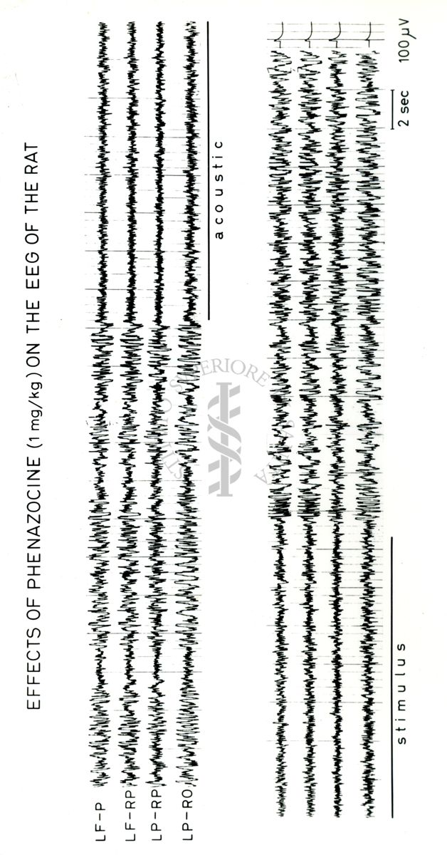 Tracciati elettroencefalografici