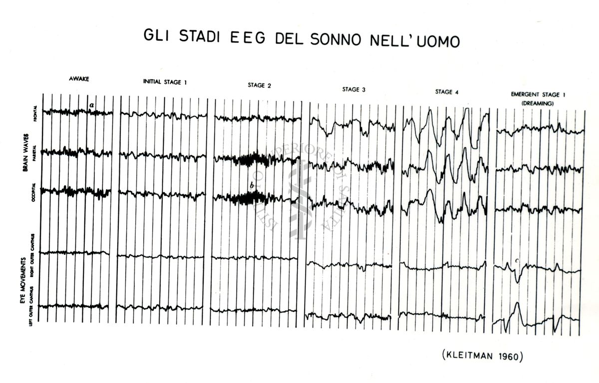 Senza titolo