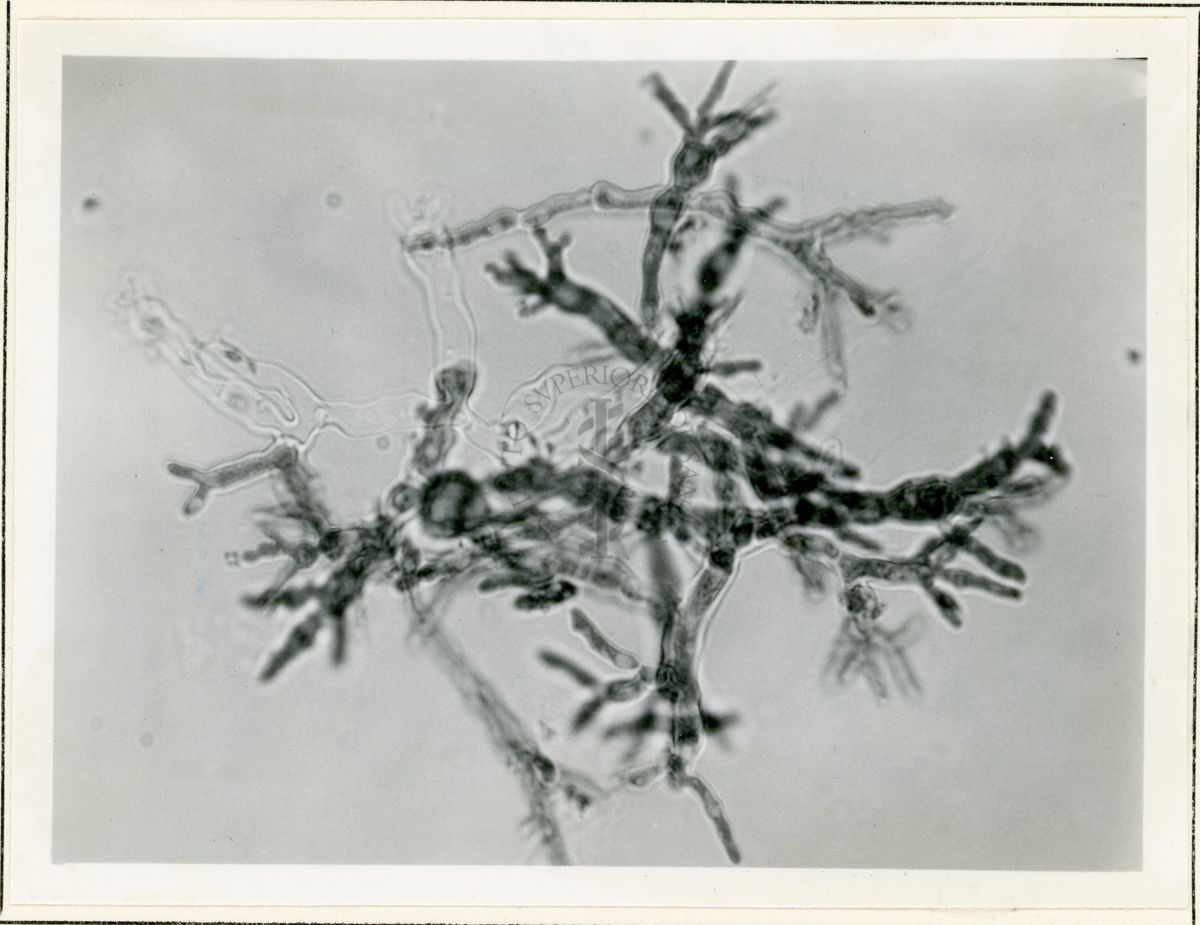 Micelio in Penicillium in coltura sommersa - 650 inrg.(2)