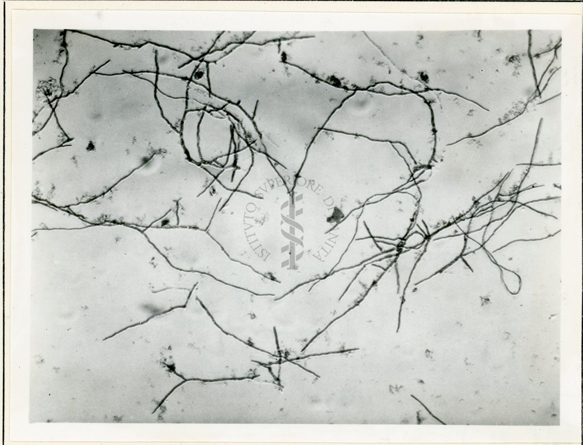 Micelio in Penicillium in coltura sommersa - 150 inrg.(11)