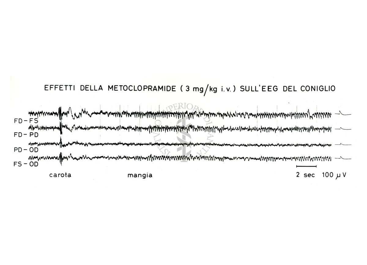 Grafico