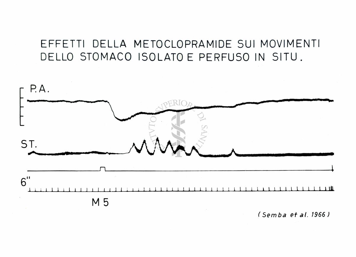 Grafico