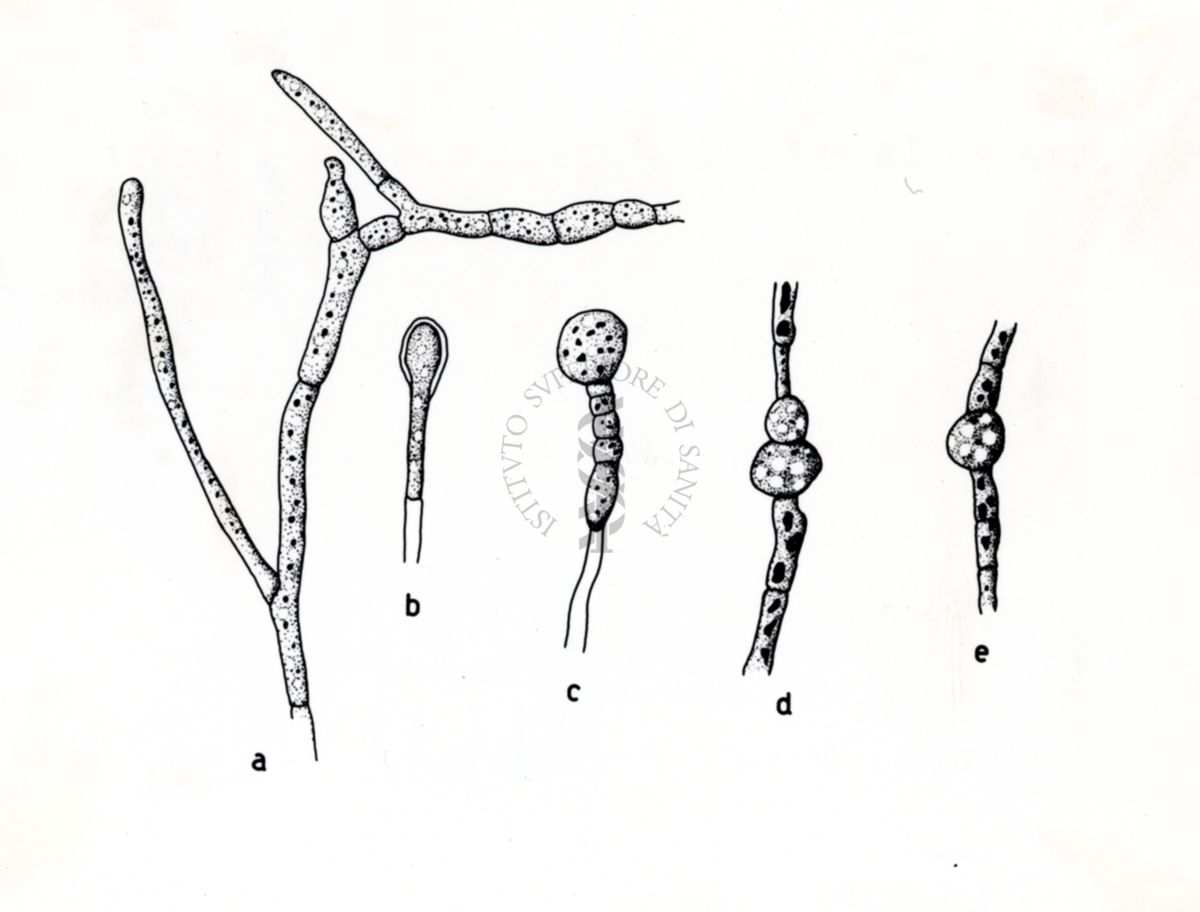 Claviceps paspali - Ife in coltura sommersa