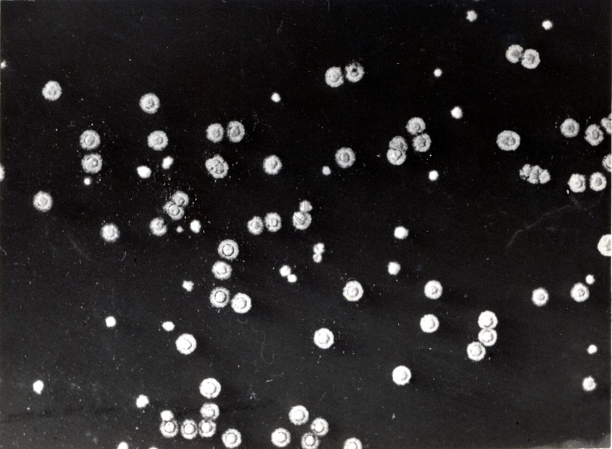 Piastra originale - Eterocloni in Streptomyces