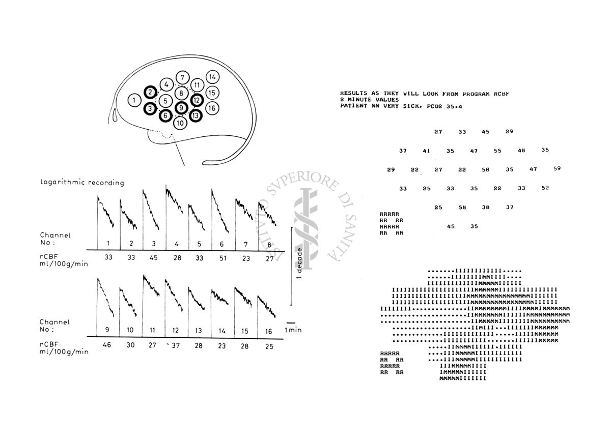 Grafico