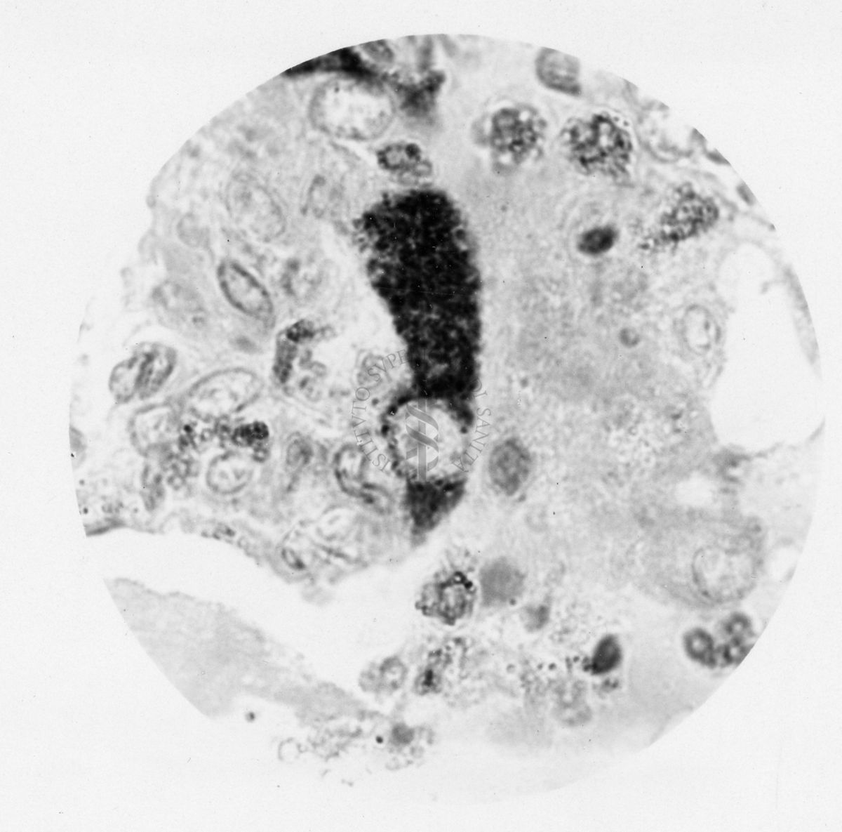 Cellule del polmone di coniglio contenente Rickettsia