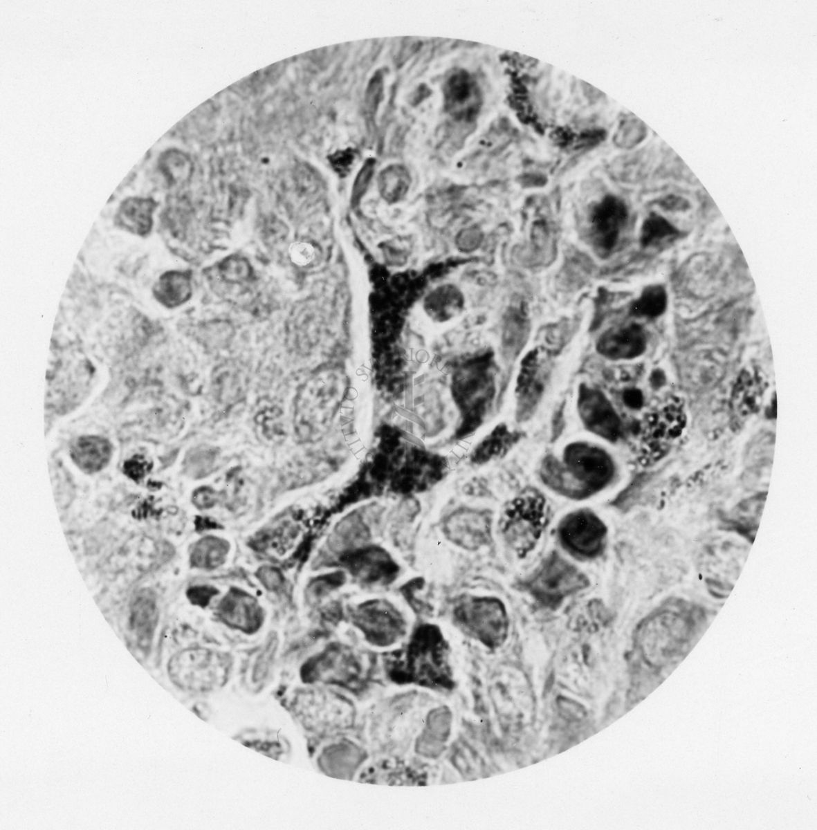 Cellule di polmone di coniglio contenenti Rickettsia