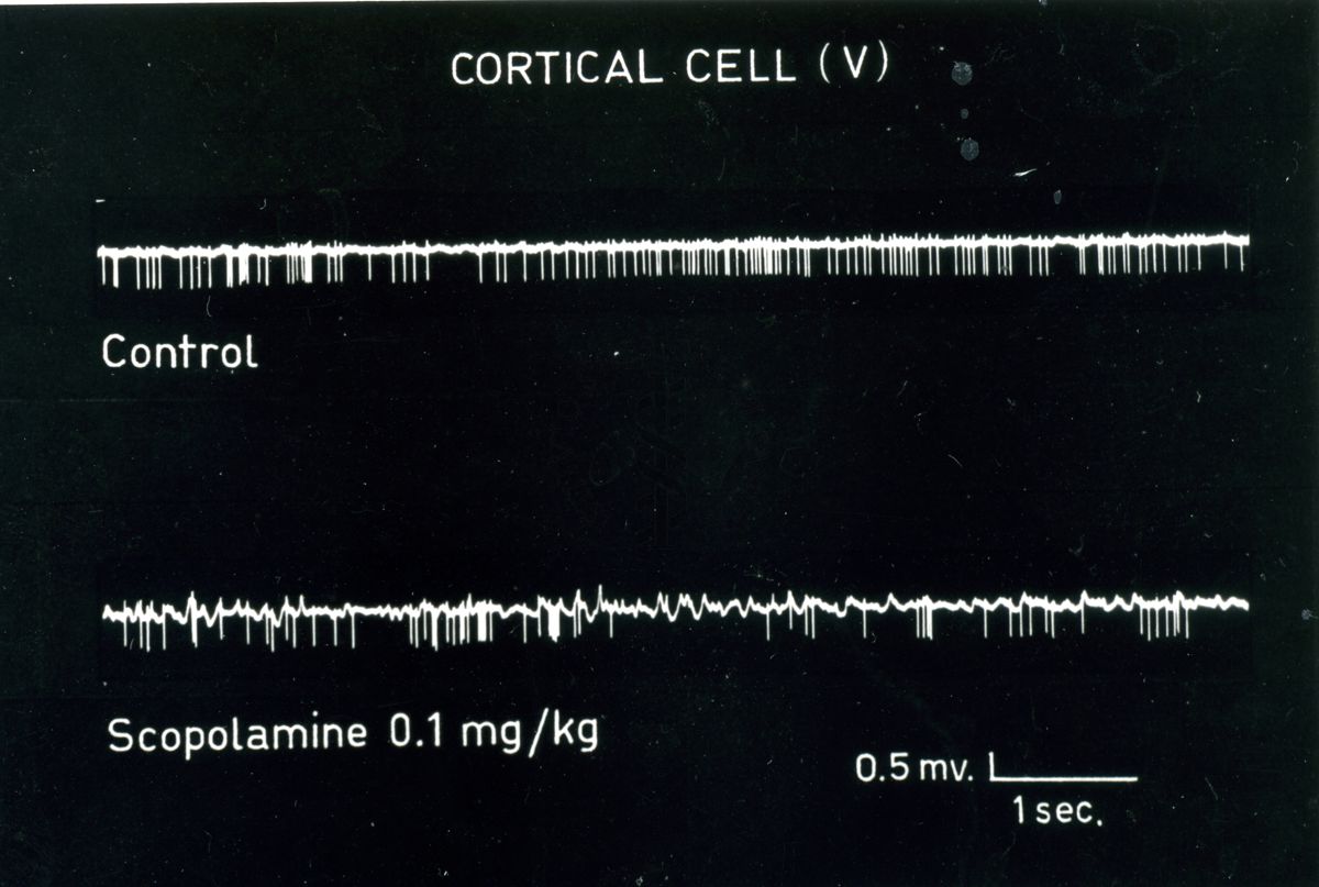 Tracciato elettico su cellule corticali trattate con scopolamina