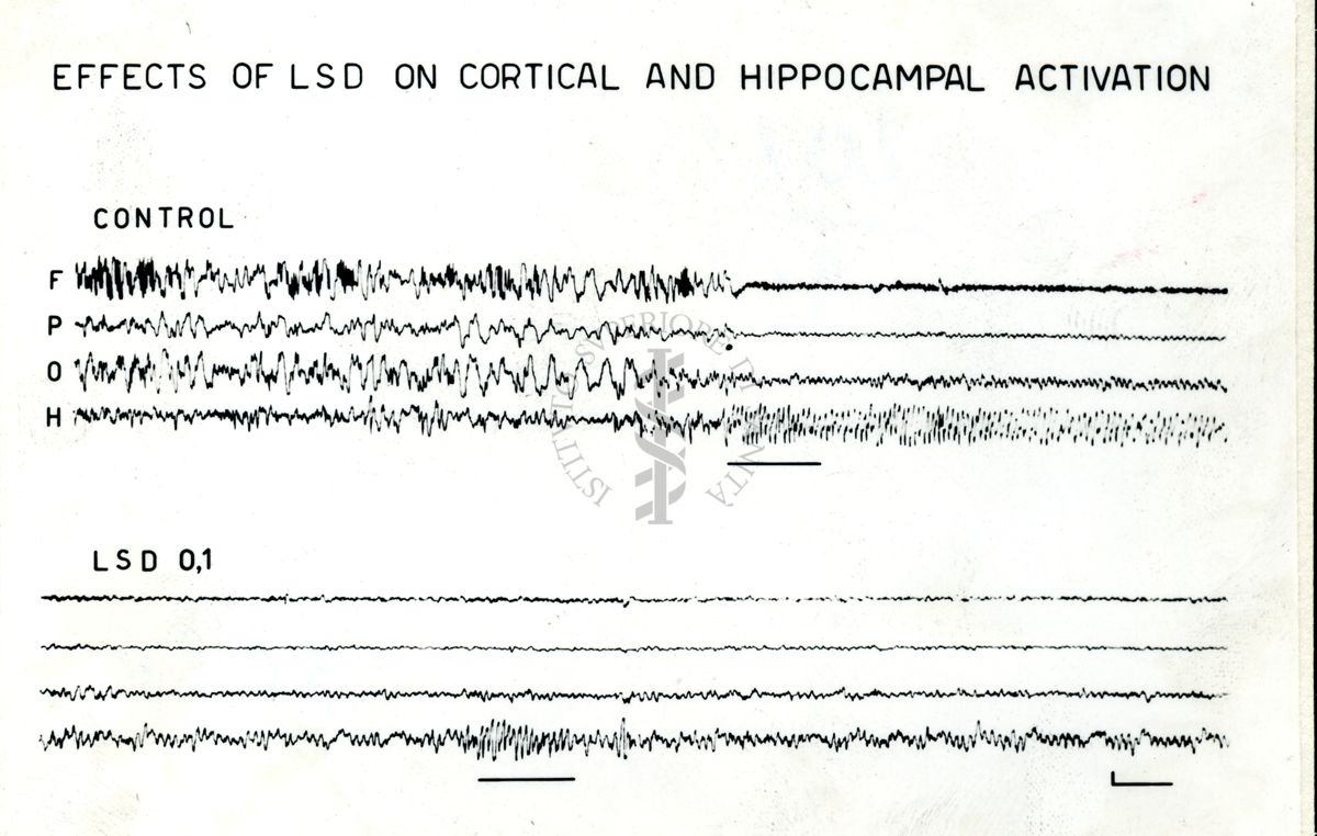 Tracciati EEG: effetti dell'LSD sull'attivazione corticale ed ippocampale