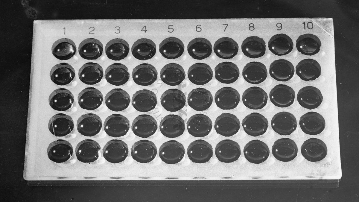 Tecnica per l'agglutinazione di Rickettsia