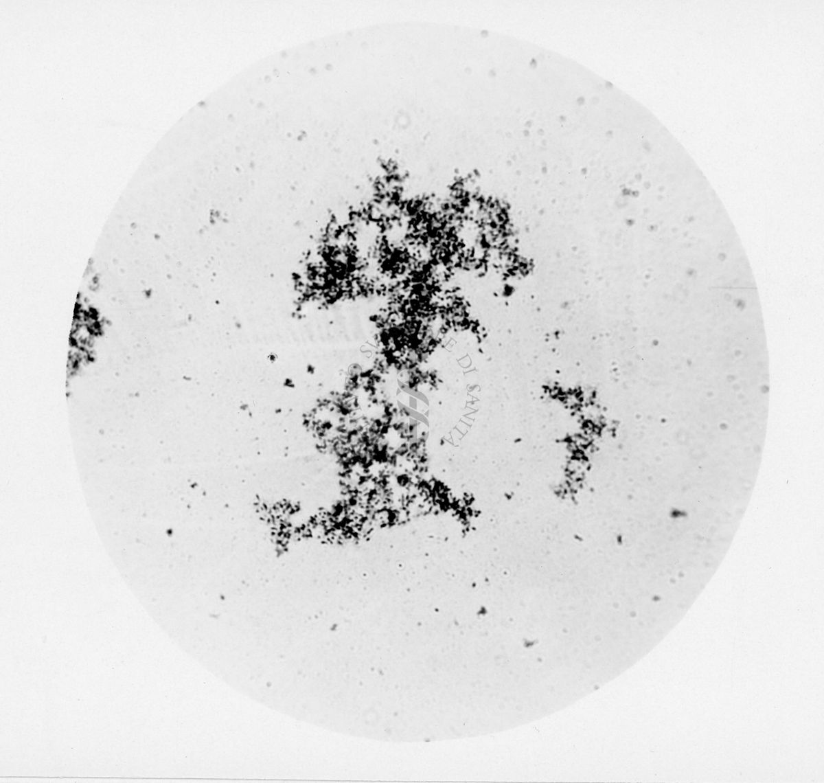 agglutinazione di Rickettsia