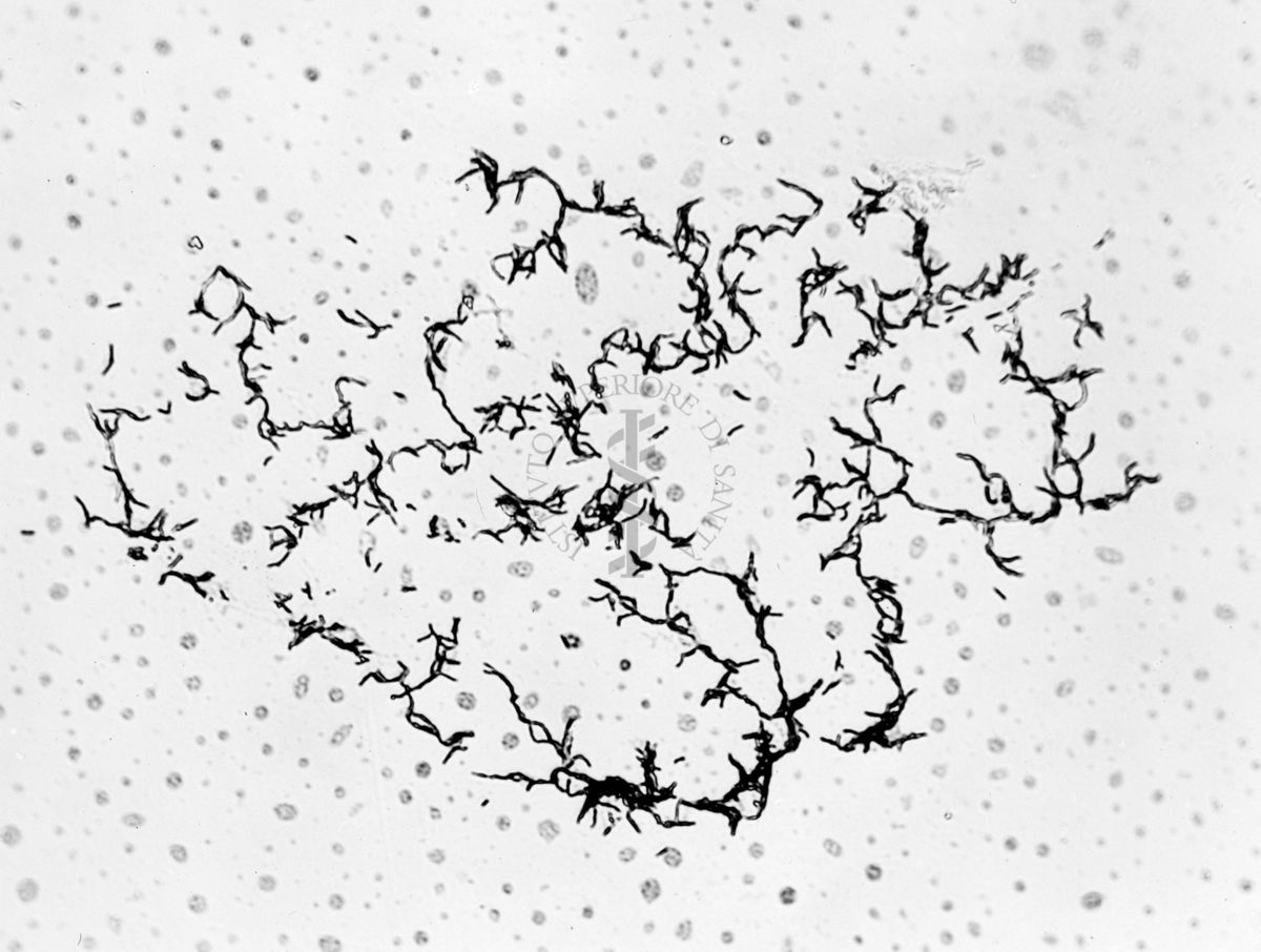 Mycobacterium sp. ceppo Chauviré