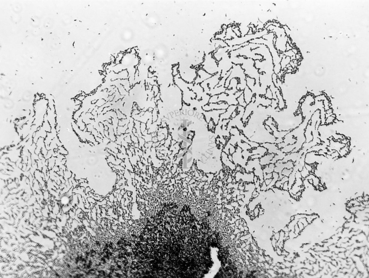 Mycobacterium sp. ceppo Chauviré