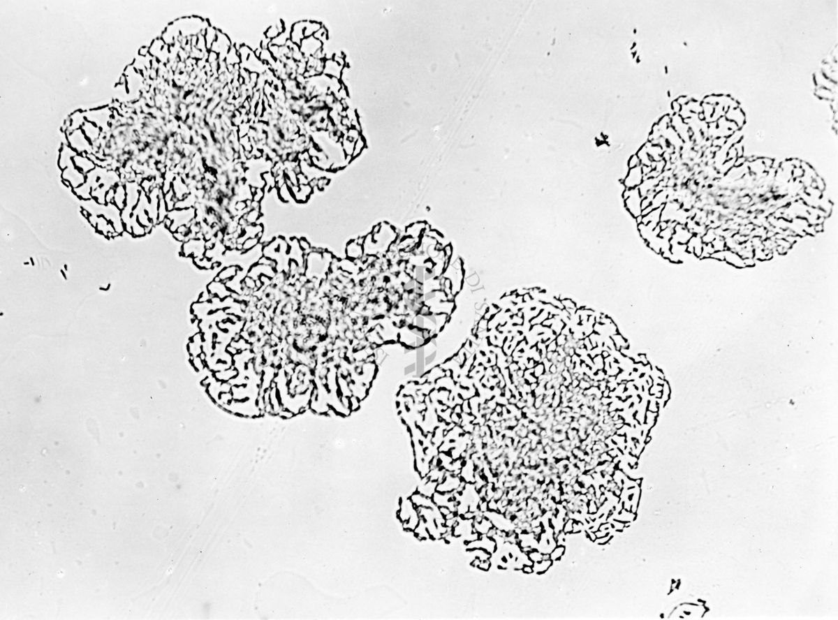 Mycobacterium sp. ceppo Chauviré