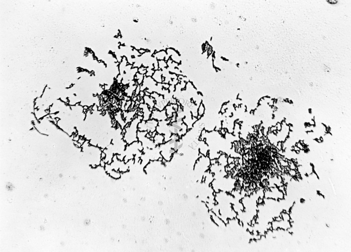 Mycobacterium sp. ceppo Chauviré