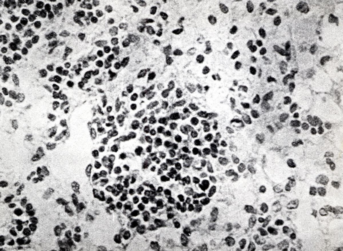 Provocazione sperimentale della flogosi iperergica produttivo-sclerotica (cuore)