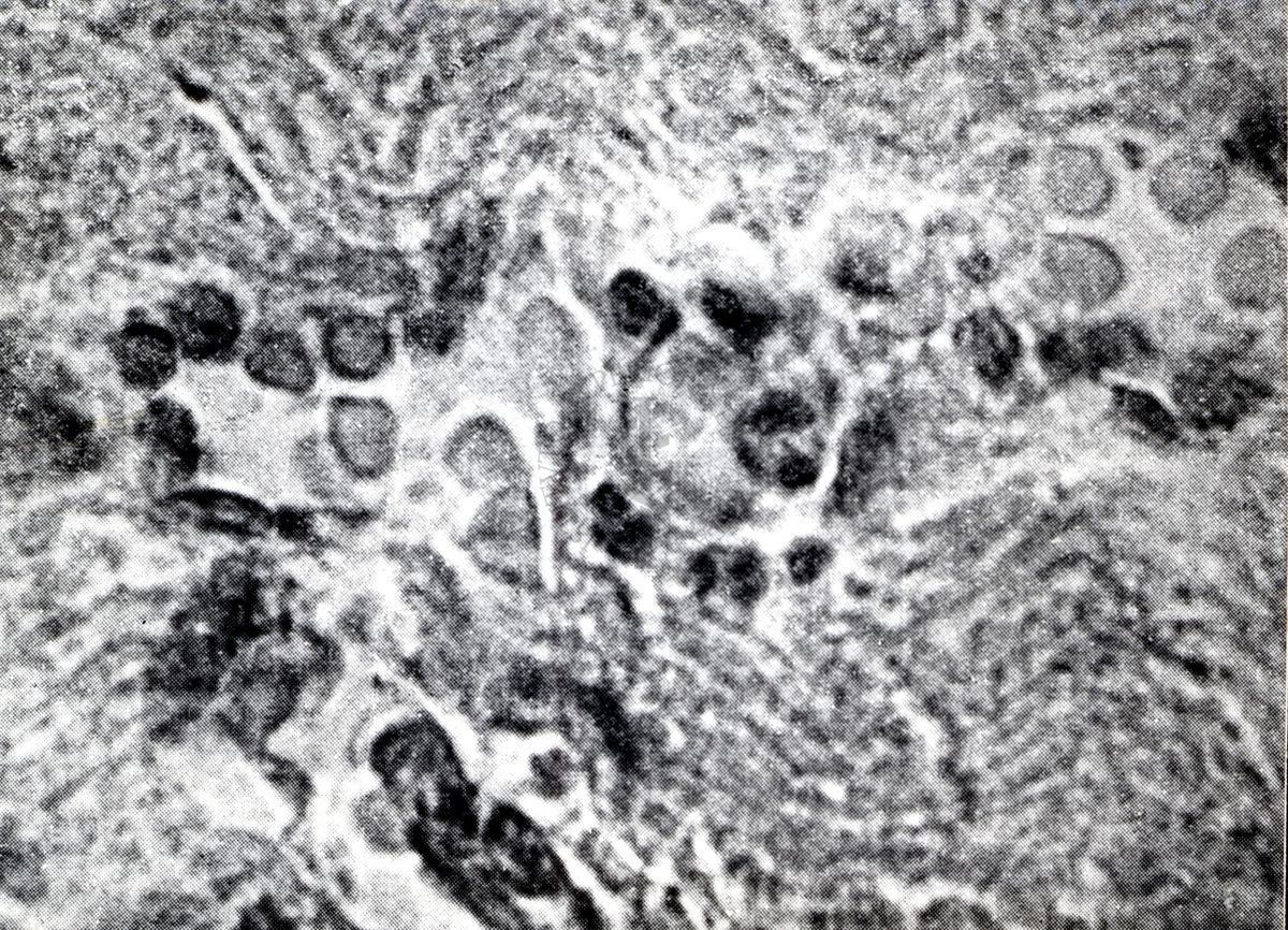 Provocazione sperimentale della flogosi iperergica produttivo-sclerotica (cuore)