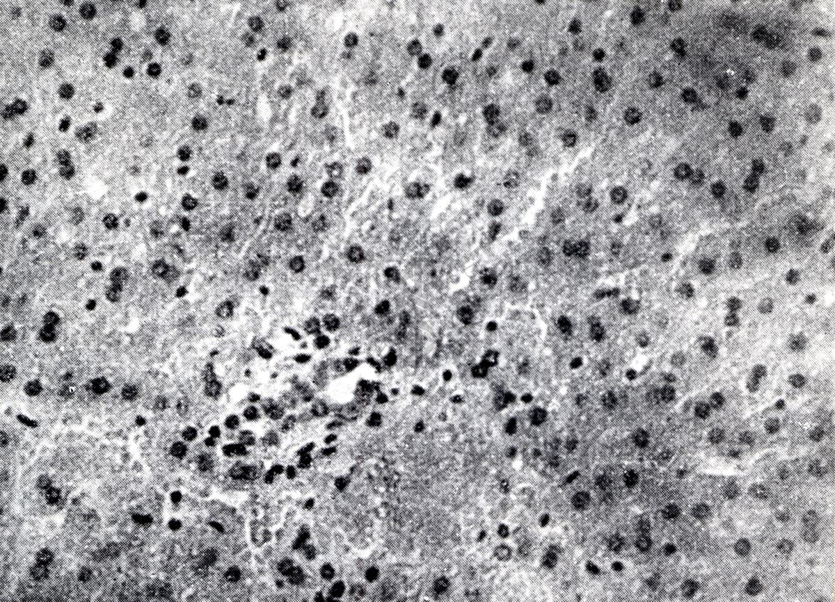 Provocazione sperimentale della flogosi iperergica produttivo-sclerotica (fegato)