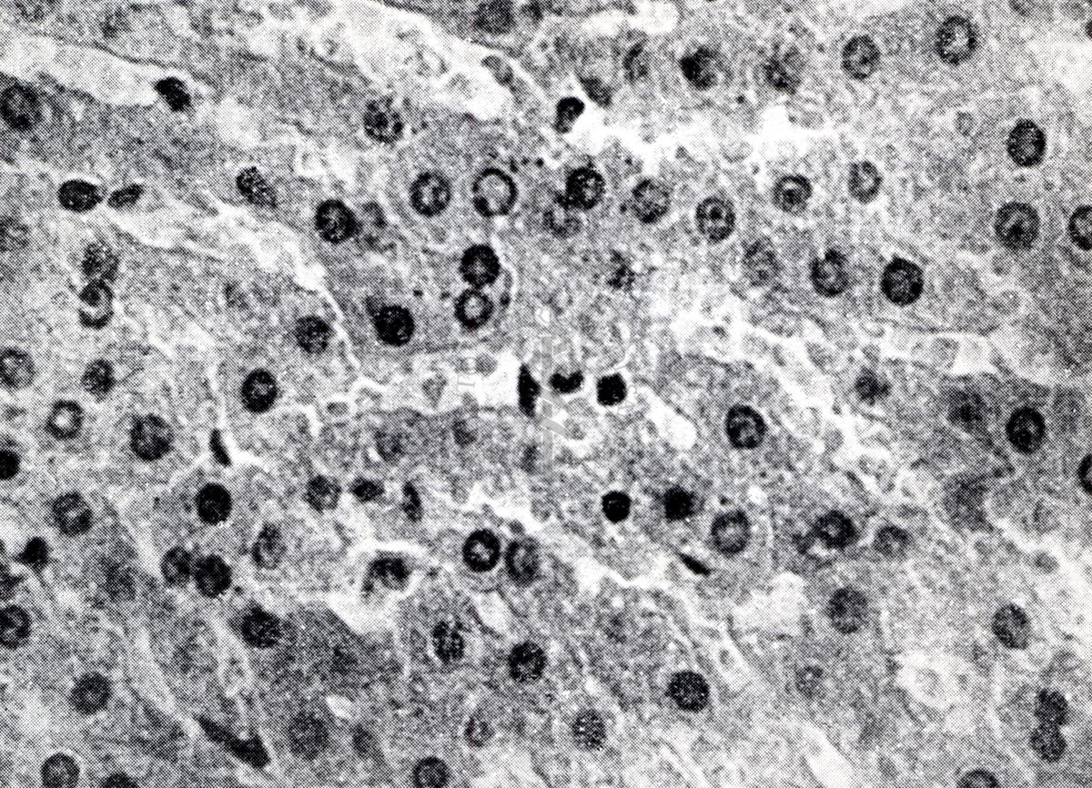 Provocazione sperimentale della flogosi iperergica produttivo-sclerotica (fegato)