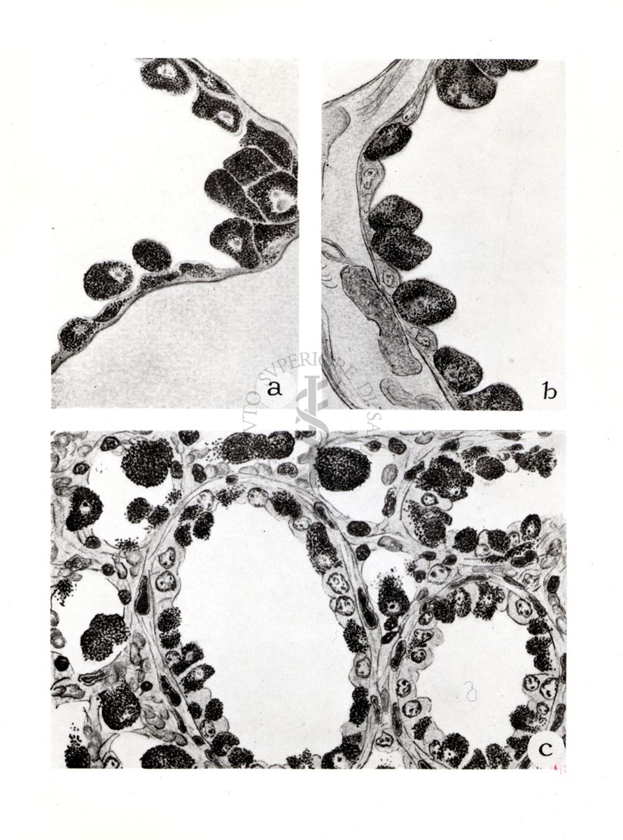 Sezione schematica polmone topo e intestino pidocchio con Rickettsia prowazeki