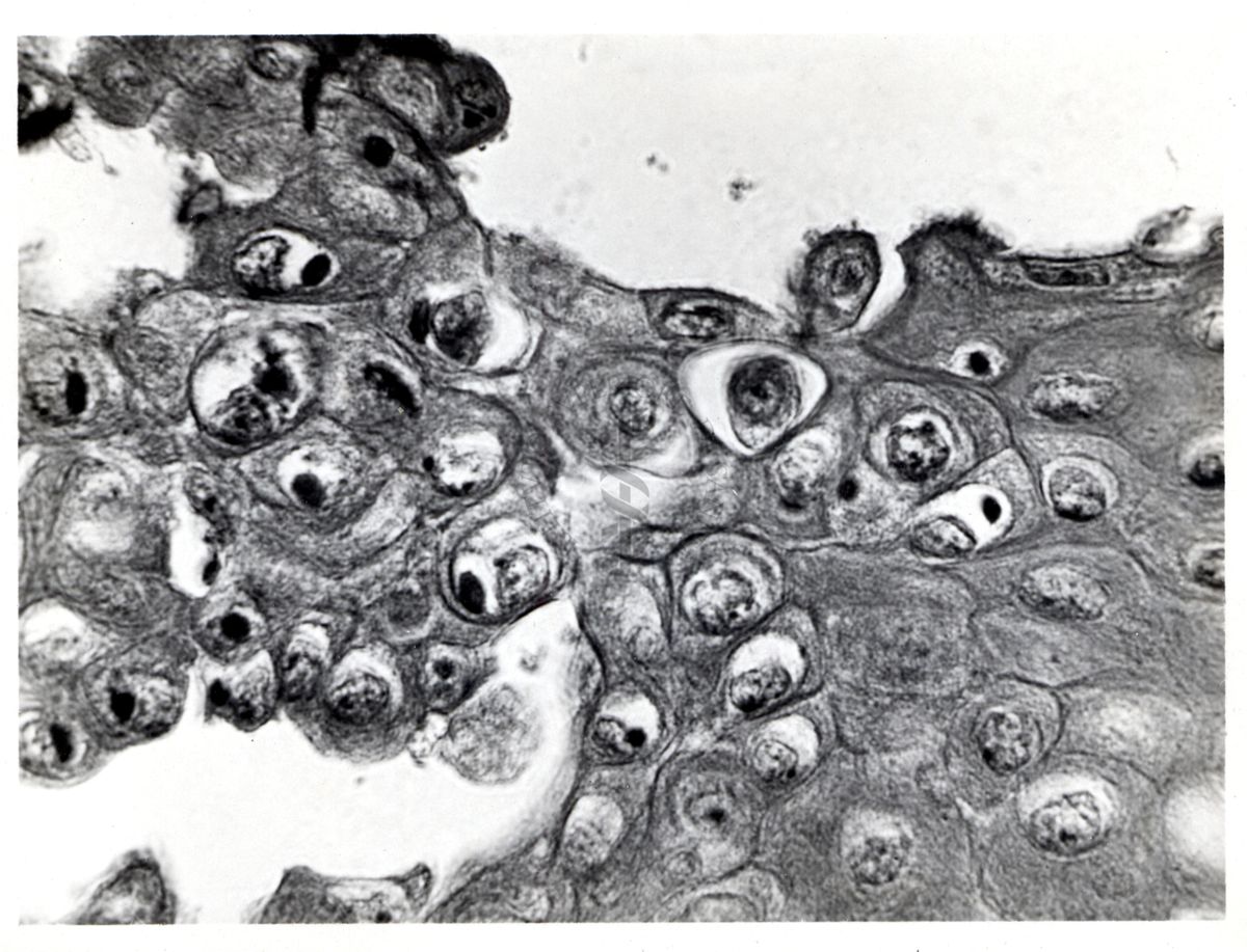 cornea di coniglio nel vaiolo