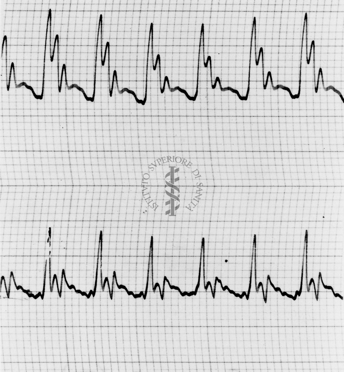 Sfigmogrammi sull'apertura e chiusura dei vasi sanguigni