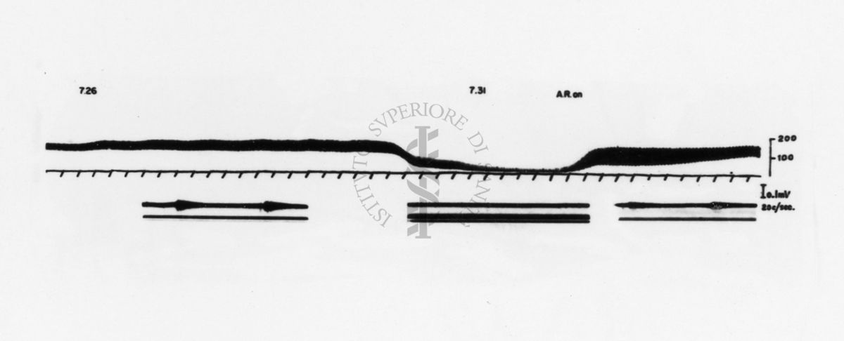 Neurogrammi del frenico