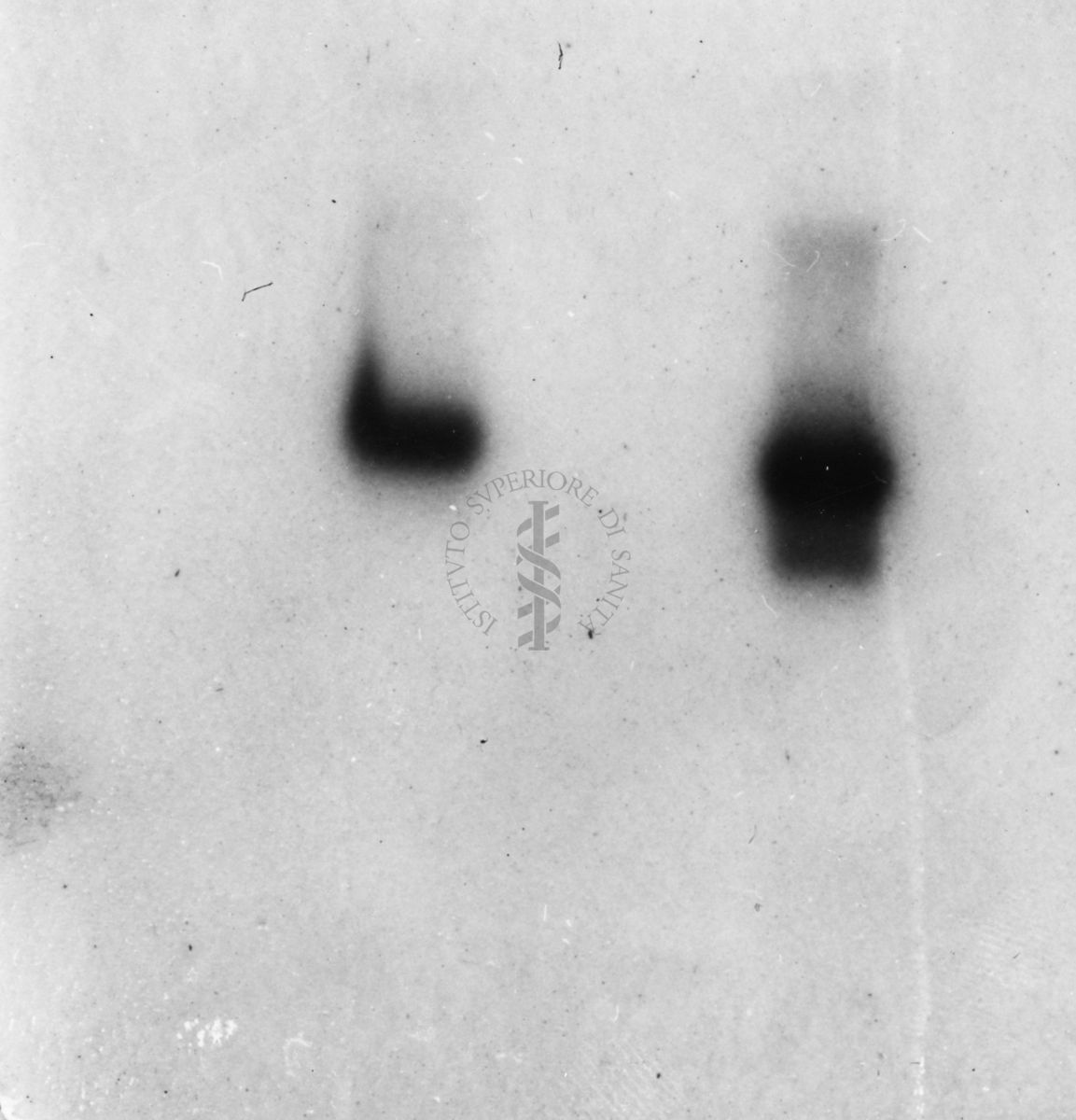 Gel riguardante studi sulla composizione in aminoacidi del peptide alfa Tp III normale e anomalo