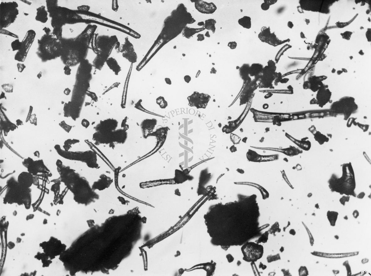 Materiale biologico ingrandito al microscopio