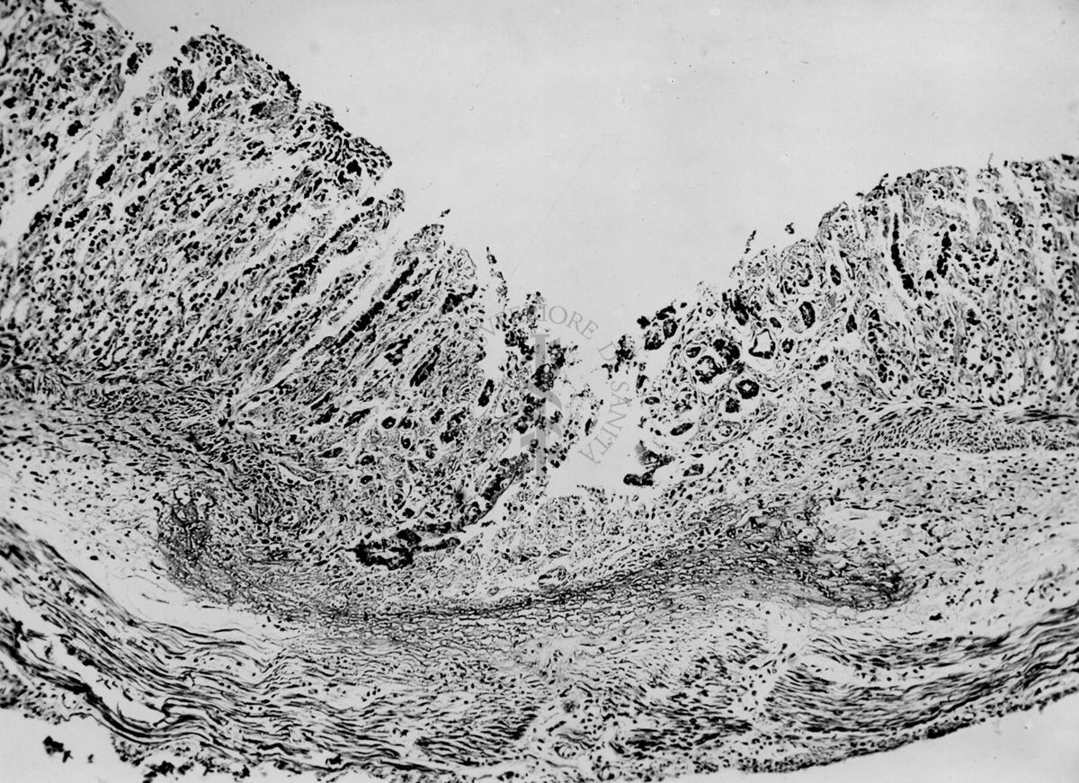 Ulcera sperimentale da istamina nella cavia (fotografie in serie) - micro fotografia originale 60 ingr.