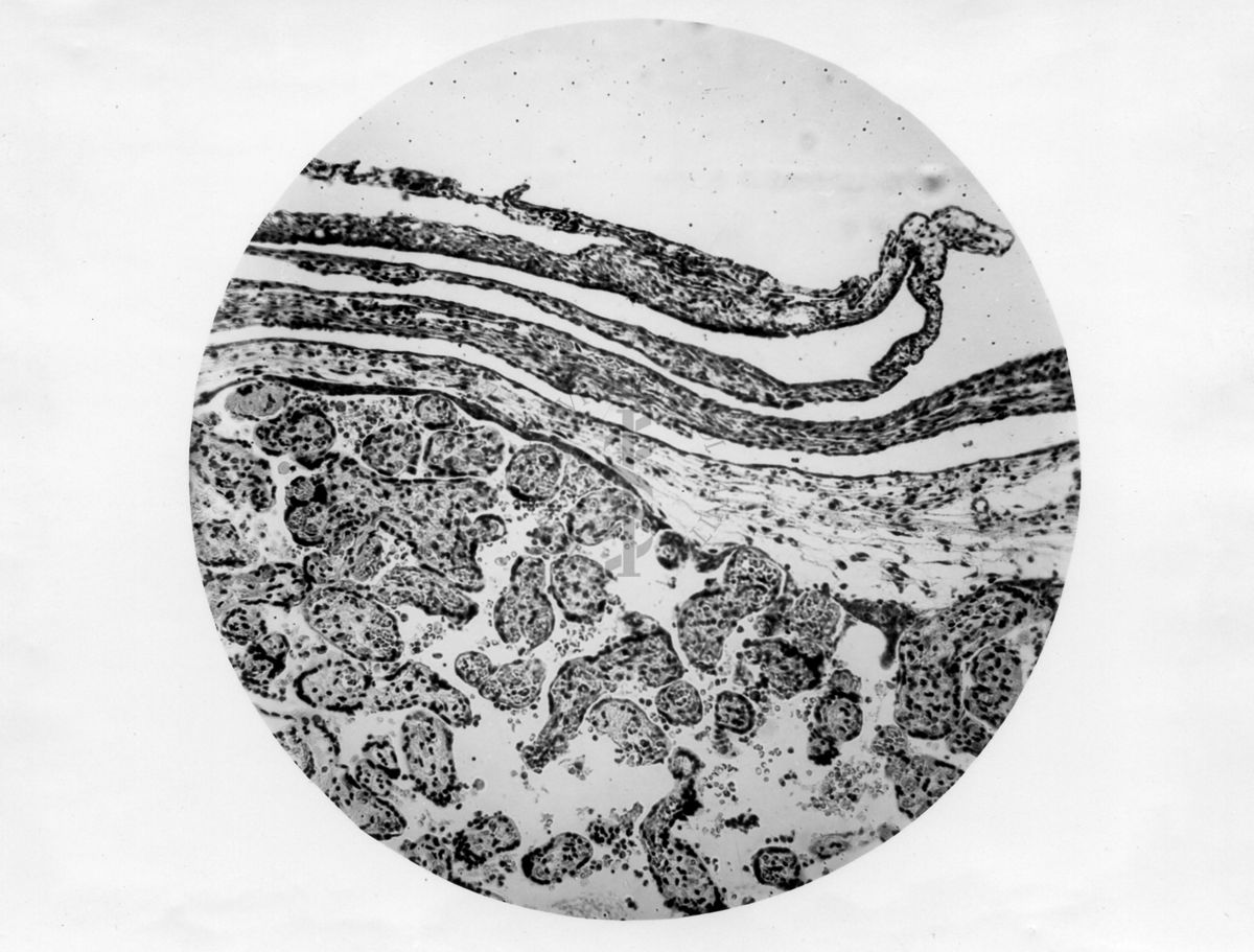 Sopravvivenza di tessuto placentare umano su membrana chorion allantoidea di pollo - micro fotografia originale 120 ingr.